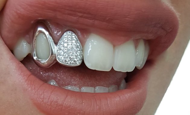 Photo de Grillz Botte Frères