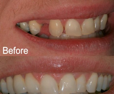 Photo of ADCC Dental Calamvale