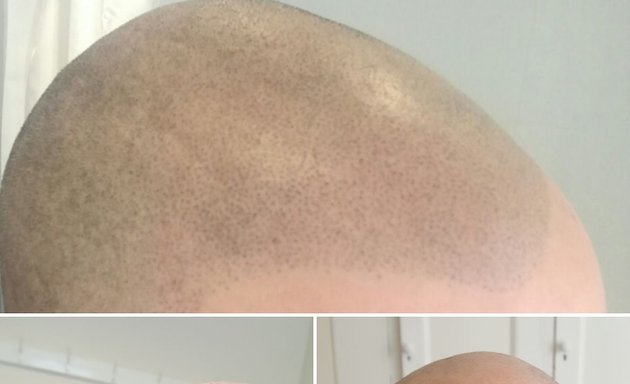 Photo of Redeem Microblading and Scalp Micropigmentation, Sheffield