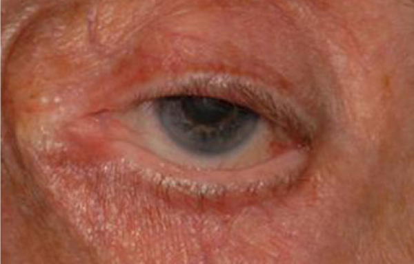 Photo of Barossa Eye Clinic