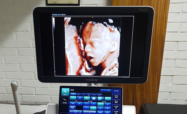 Foto de Dr. Diego Rodríguez Llort ginecólogo y obstetra ultrasonido 5D