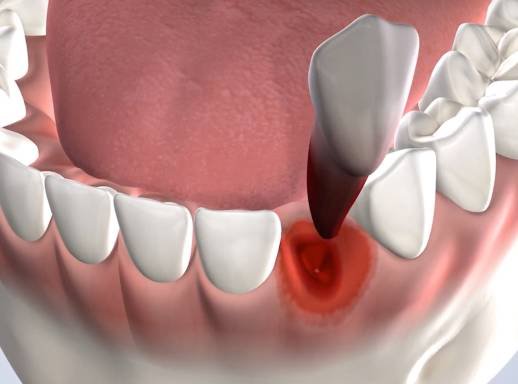 Photo of Park Cities Oral & Maxillofacial Surgery Associates- Dental Implant Experts