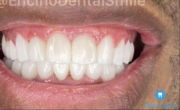 Photo of Encino Dental Smile