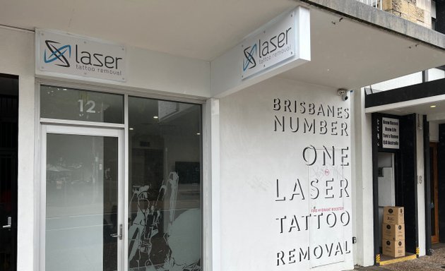 Photo of Laser Tattoo Removal Australia