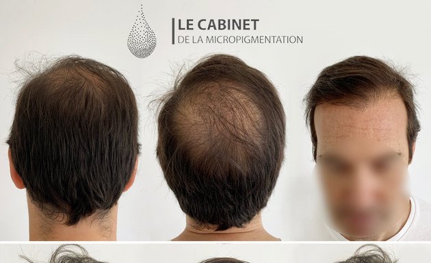 Photo de CABPIGMENT : cabinet de micropigmentation