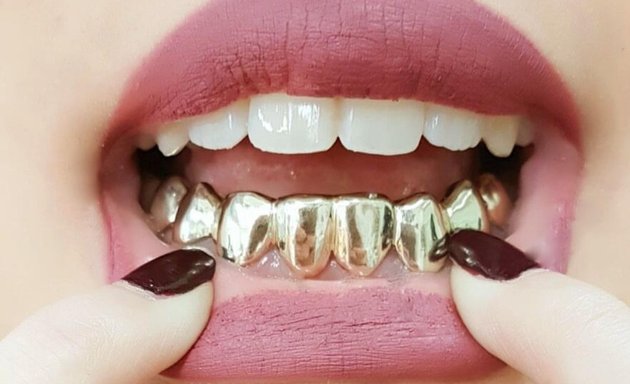 Photo de Grillz Botte Frères