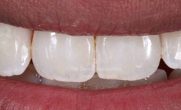 Photo of Bay Dental Associates : Teeth Whitening & Cleaning | Root Canal Treatment | Dental Clinic in Grant Road | Dentist in Grant Road | Pediatric Dentistry | Orthodontist | Dental Implants | Braces , Crown , Smile Makeover in Grant Road