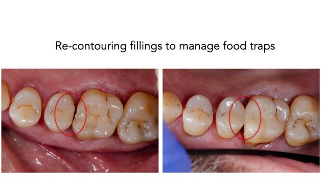 Photo of Helderberg Dental Practice | Somerset West Dentists