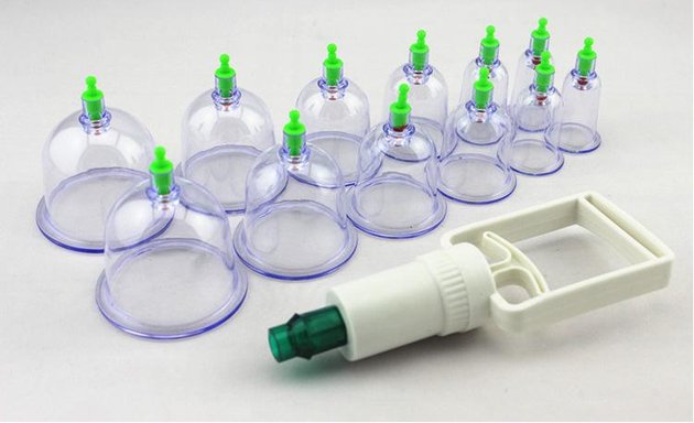 Photo of Safrozs Cupping Therapy