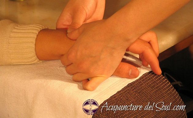 Photo of Acupuncture Del Soul