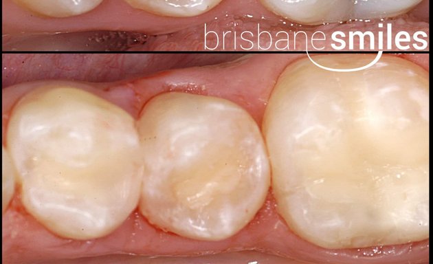 Photo of Brisbane Smiles - Toowong