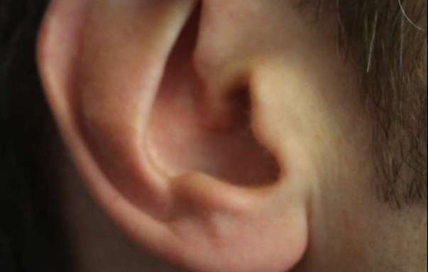 Photo of ear Aesthetics and Reconstruction