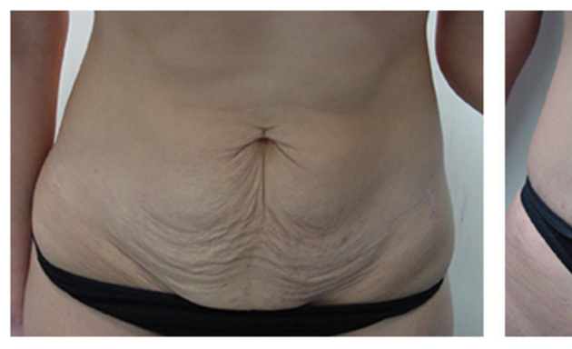 Photo of Royal Laser & Skincare Clinic - Laser Hair Removal