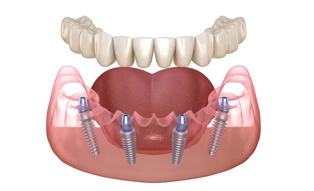 Photo of Aria Dental Implant Center