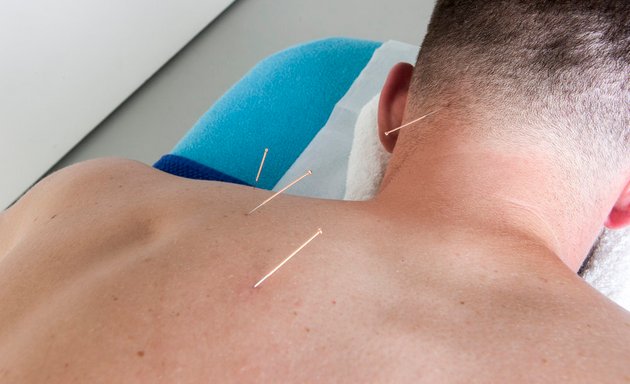 Photo of Julien Burnier Massage Therapy & Medical Acupuncture