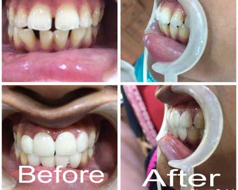 Photo of Dental Perfection : Dental Implants | Smile Design | Crown | Bridges | Denture | Teeth Whitening | Oral surgeon | Root Canal Treatment | Home Visit | Cosmetic & Cheap & Kids Dentist | Best Dental Clinic | Best Dentist in Goregaon