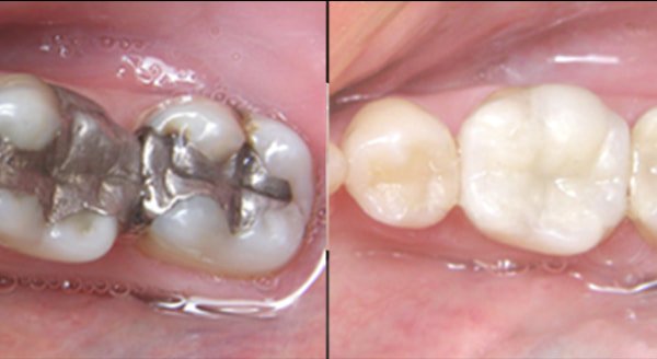 Photo of Lakeport Dental
