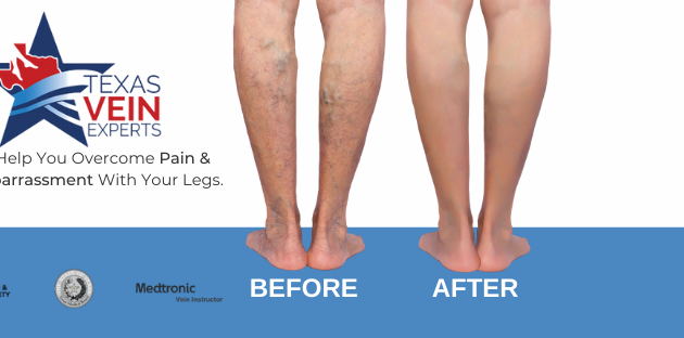 Photo of Texas Vein Experts - Dallas