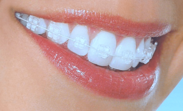 Photo of Dentist Implants USA