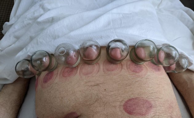 Photo of CuppingNYC