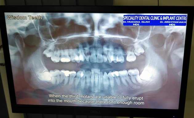 Photo of Speciality Dental Clinic & Implant Centre