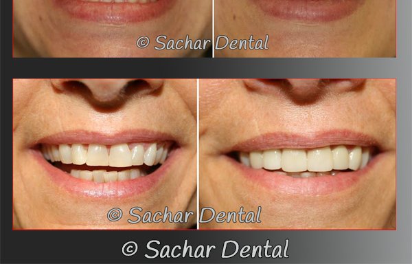 Photo of Sachar Dental NYC