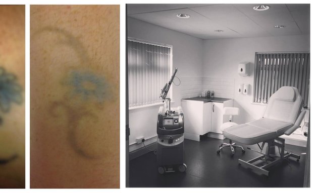 Photo of Bristol Tattoo Removal Clinic