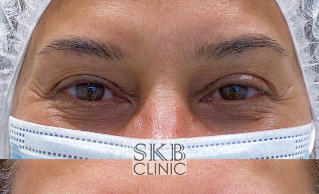 Photo of SKB Clinic Microblading & Permanent Makeup