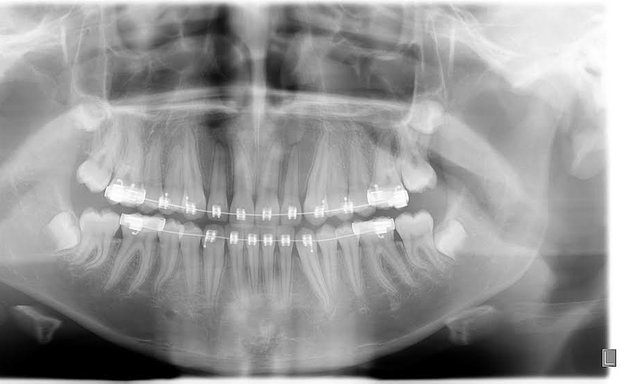 Foto de RAYDENT Radiografía Dental