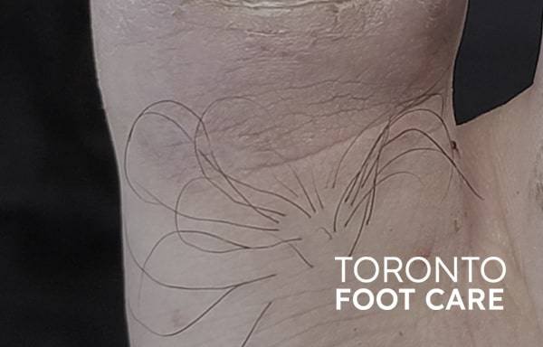 Photo of Toronto Foot Care