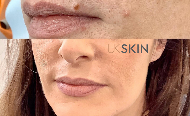 Photo of uk Skin