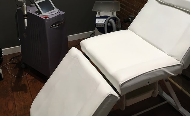 Photo of Point Blank Tattoo Removal