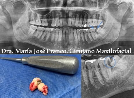 Foto de Dra. María José Franco Barrera - Cirujano Maxilofacial