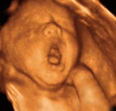 Photo of UC Baby 3D Ultrasound