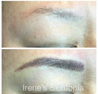 Photo of Irene's Skintopia Med Spa