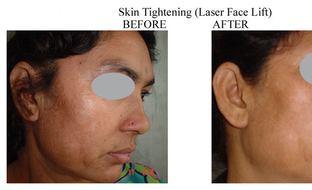 Photo of Amrit Laser & Cosmetic Surgery Clinic