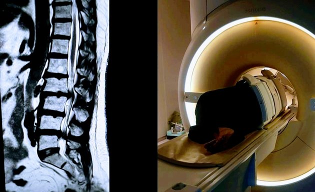 Photo of Free MRI Scan & CT Scan