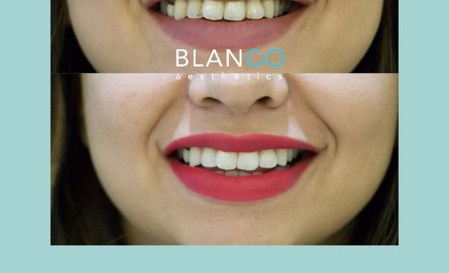 Photo of Blanco Aesthetics Dental & Skin Clinic