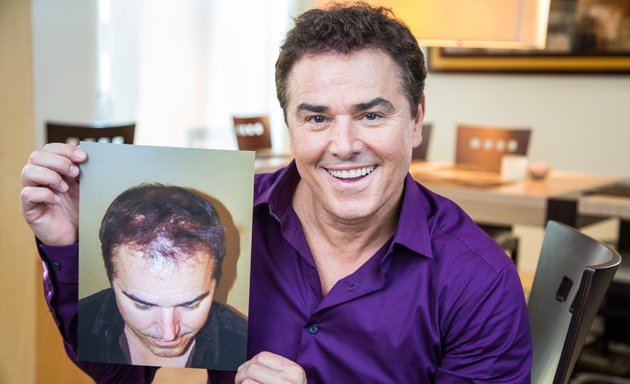 Photo of Bosley - Hair Restoration & Transplant