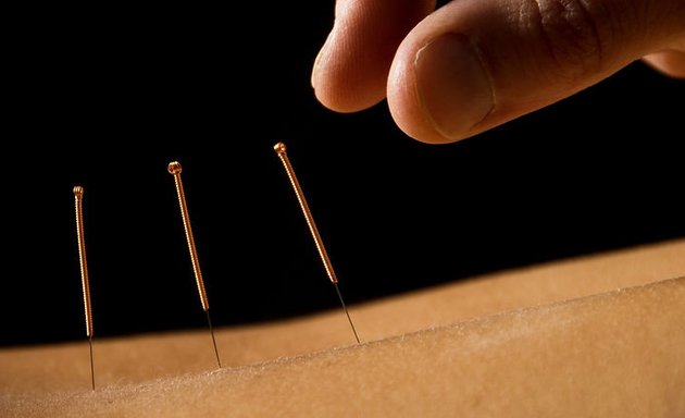 Photo of Acupuncture and Herbs