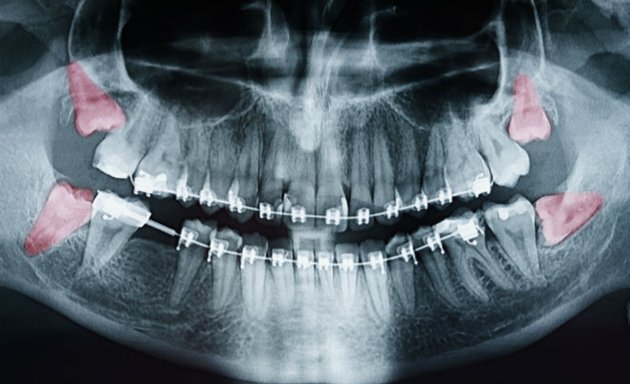 Photo of Clinique Spécialisée de Québec - Dr Jean El-Fata, chirurgien buccal et maxillofacial