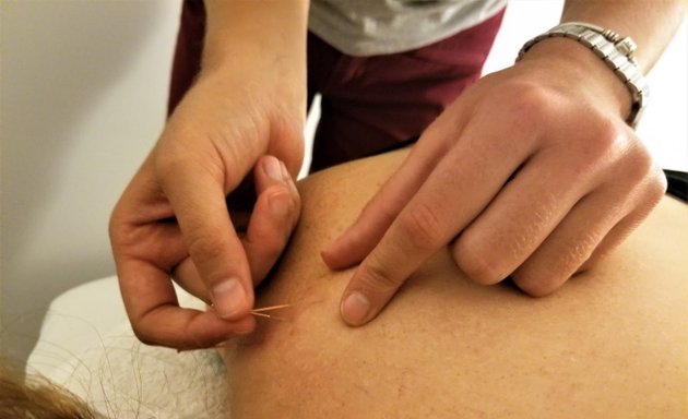 Photo of Acupuncture, Eléonore Keyes