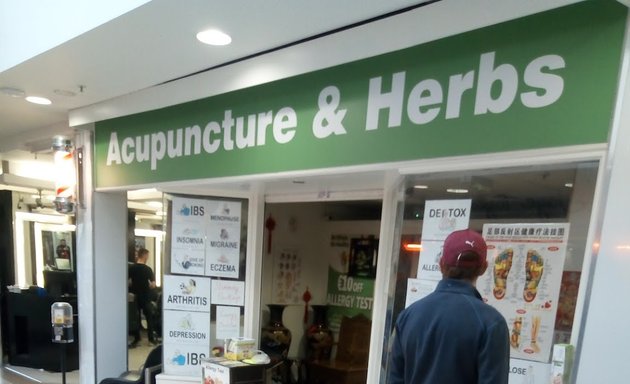 Photo of Acupuncture & herbs