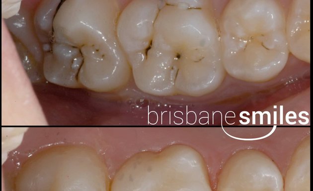 Photo of Brisbane Smiles - Toowong