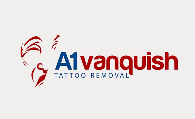 Photo of A1 Vanquish Tattoo Removals