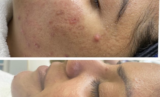 Photo of JuvyDerm Skin Care And Laser Centre