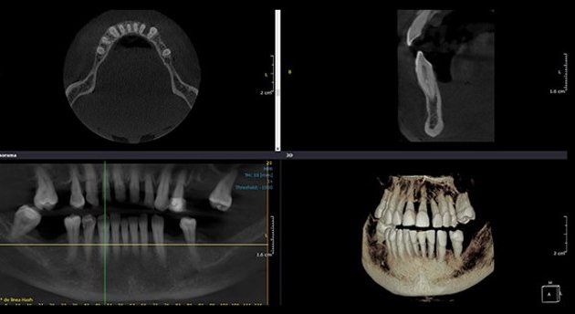 Foto de Centro Radiológico Dental Acreditado - 3CRay