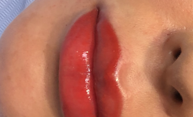 Photo of Lips N Lines