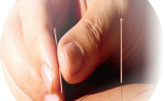 Photo of Acupuncture & Chinese medicine--AcuPro Clinic