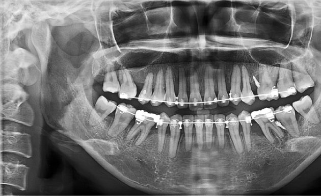 Foto von PRO CLINIC : spécialiste en radiologie dentaire